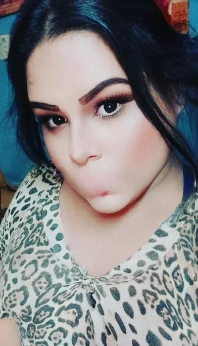 Yussi