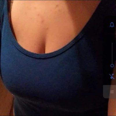 Anna593